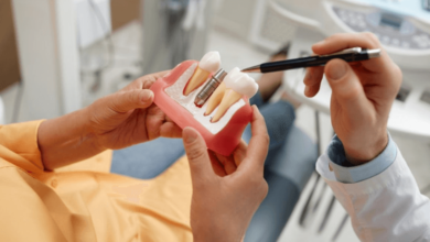Dental Implants: A Permanent Solution for a Healthier, Confident Smile