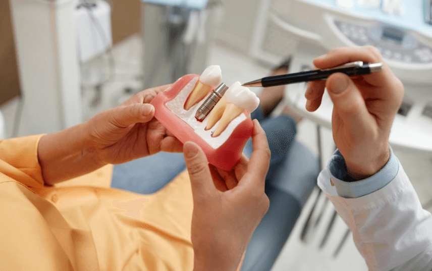 Dental Implants: A Permanent Solution for a Healthier, Confident Smile