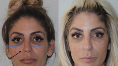 Reconstructive Surgery Options in New York City: What You Need to Know