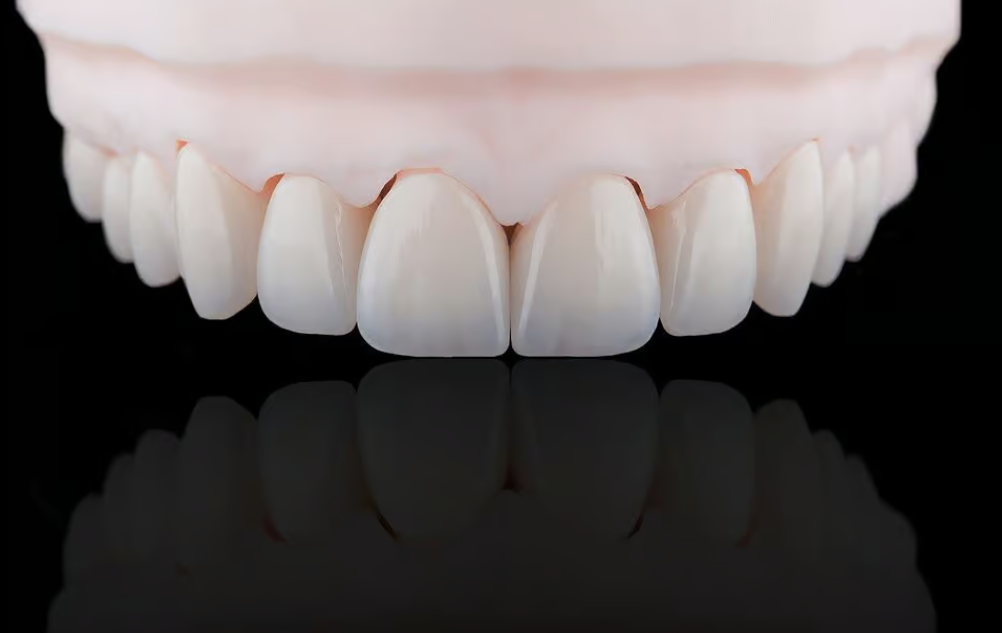 Porcelain vs Zirconia? The Science Behind Choosing the Right Dental Crown