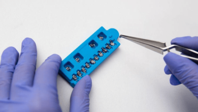 Navigating the World of Dental Braces: Options and Considerations in Orthodontic Care
