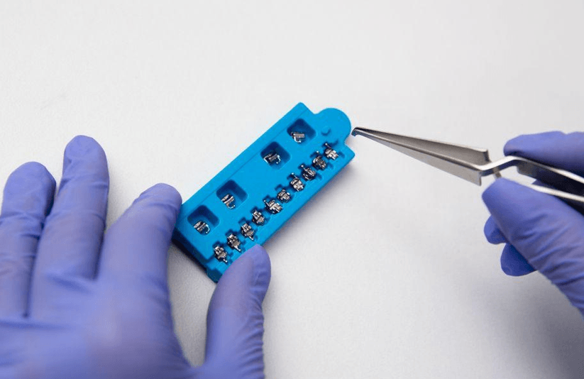 Navigating the World of Dental Braces: Options and Considerations in Orthodontic Care