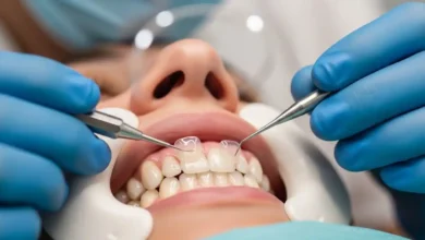 Do Porcelain Veneers Permanently Damage Your Teeth Underneath?