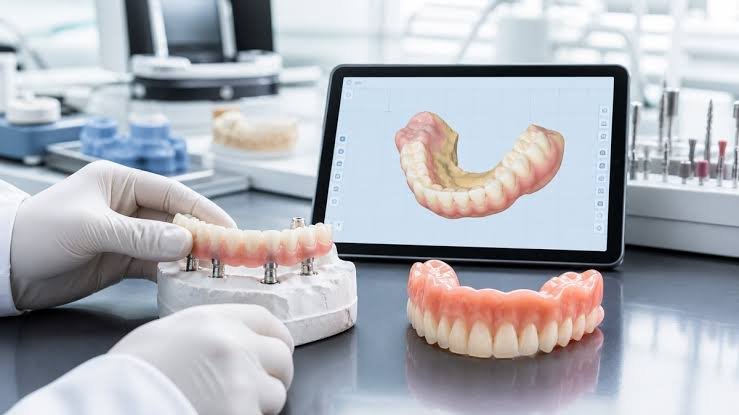 Modern Dentures Look Less Artificial Than They Did a Decade Ago